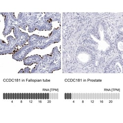 CCDC181 Antibody, Novus Biologicals:Antibodies:Primary Antibodies